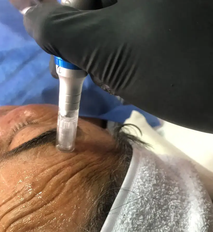 Procedimiento estético